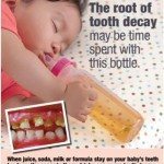 Help prevent Tooth Decay NYC-ToothDecay