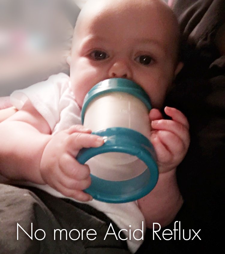 Acid reflux in bottle fed babies