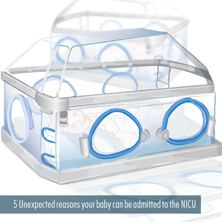 5 Unexpected reasons your baby can be admitted to the NICU