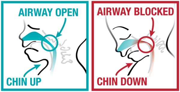 Chin up vs. Chin down