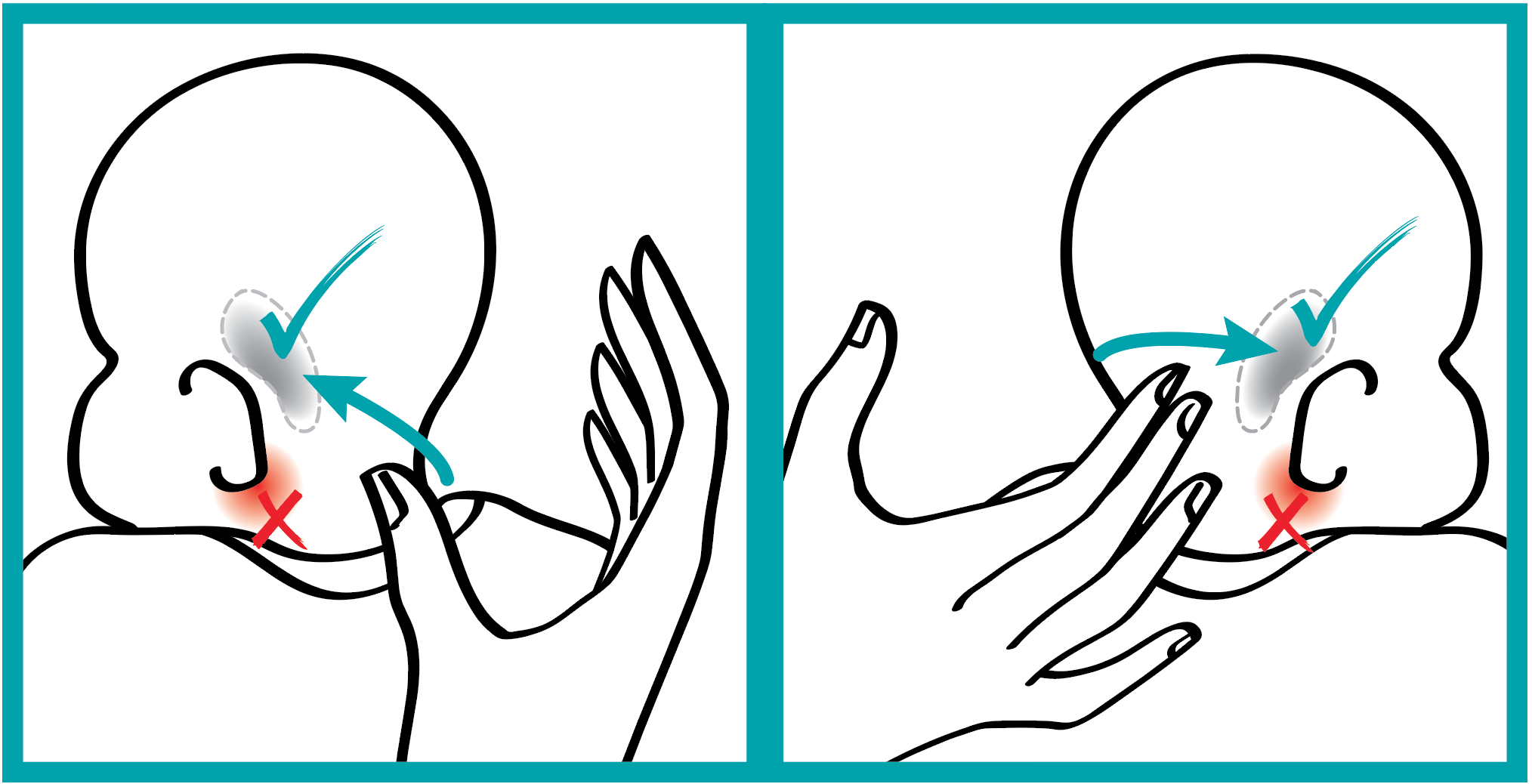 Newborn Upright Feeding Bare® Airfree Feeding System by Bittylab®
